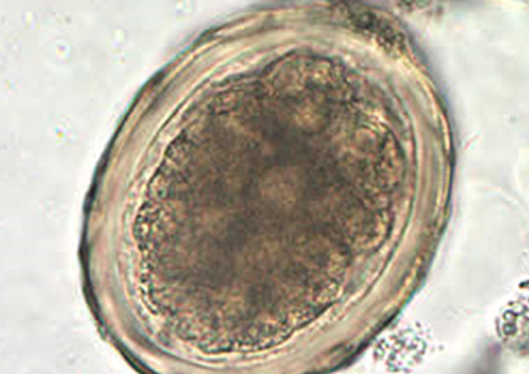 消化管寄生虫症