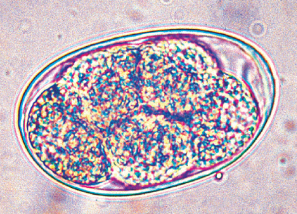消化管寄生虫症